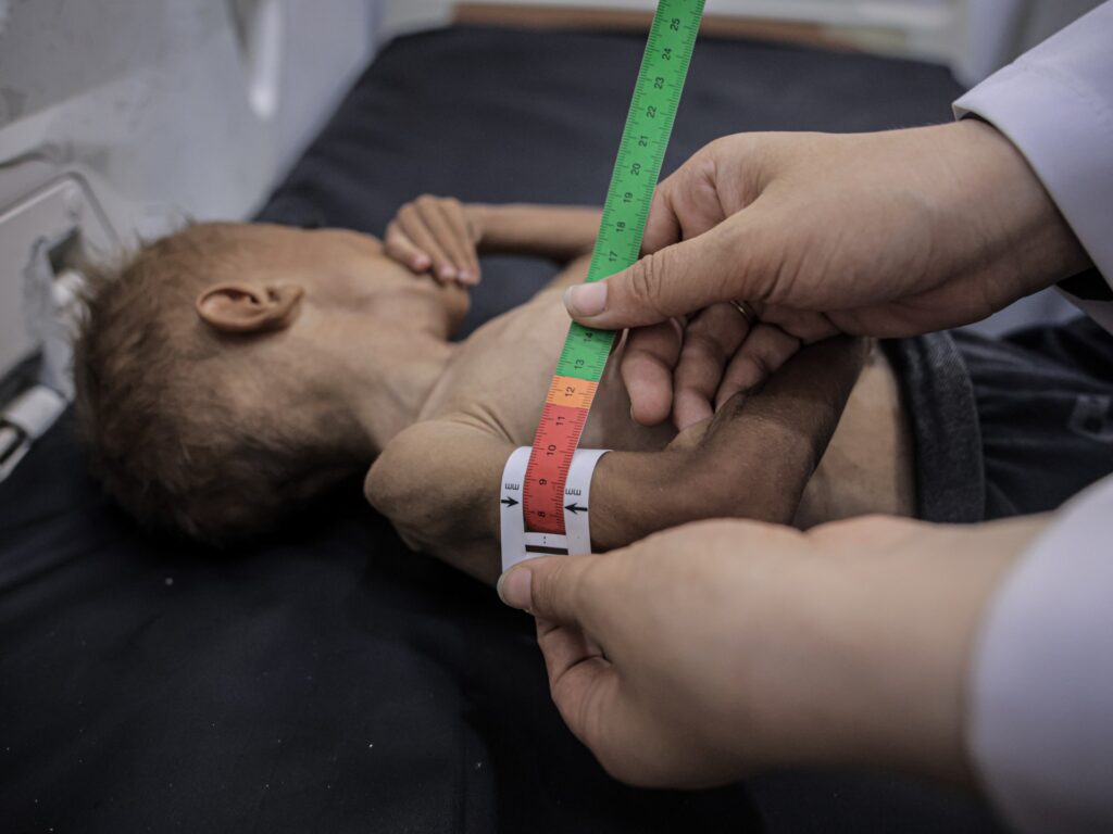 Food alone won’t save Gaza’s starving population | Hunger