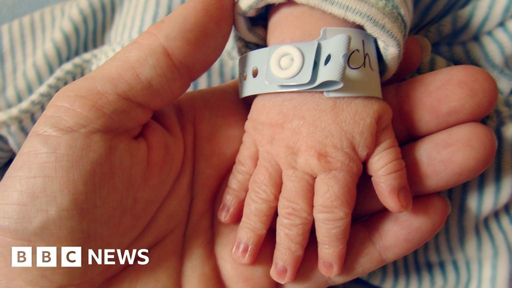 Damning report finds ‘culture of mistrust’ at Edinburgh maternity unit Damning report finds 'culture of mistrust' at Edinburgh maternity unit